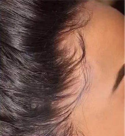 HD Transparent Lace 13x4 13x6 Full Frontal 360 Lace Straight 5x5 Closure 200 Density Human Hair Pre plucked Wigs 200 Density Store name Sterly US Store Store ID 1104102410